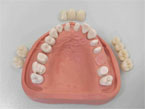 Hardt Dental-Labor: Beispiel Varianten der Vollkeramik
