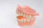 Hardt Dental-Labor: Beispiel ... mit hochwertigen Kunststoffzähnen